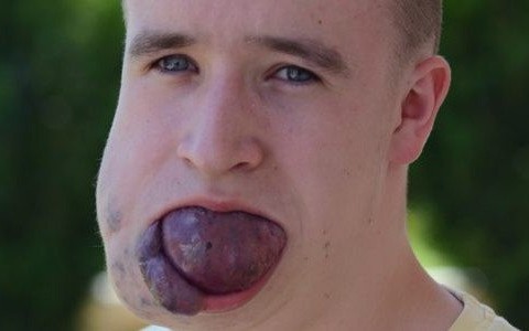 Krzysztof Węgrzyn potrzebuje Waszej pomocy