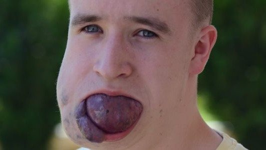 100 tysięcy dla Krzyska w zaledwie dwa dni!