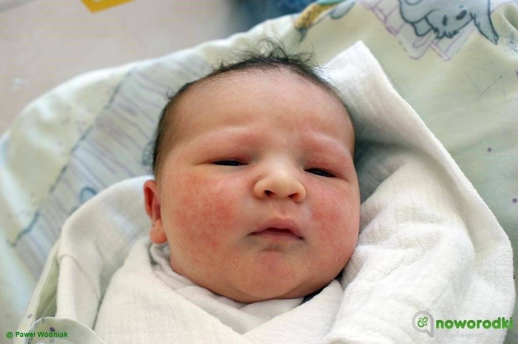 Noworodkowa galeria eFO – FOTO