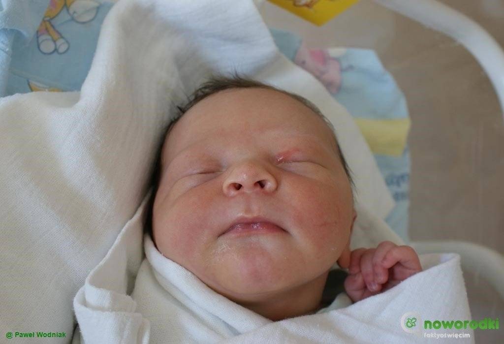 Noworodkowa galeria eFO – FOTO