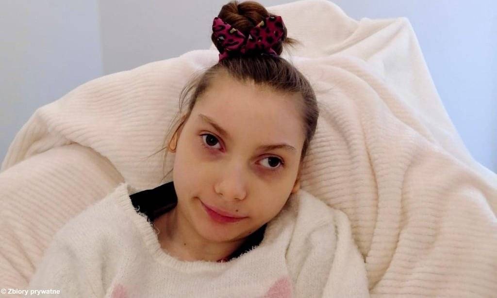 Milenka potrzebuje pomocy i kosztownej operacji – FOTO