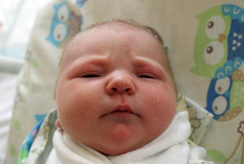 Noworodkowa galeria eFO – FOTO