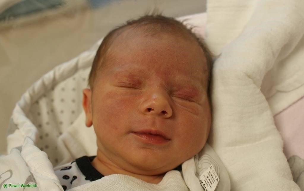 Noworodkowa galeria eFO – FOTO