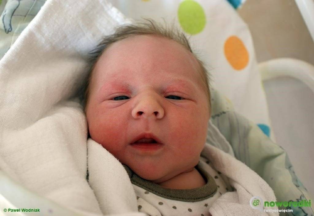 Noworodkowa galeria eFO – FOTO