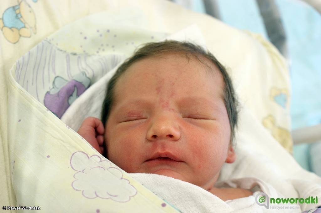 Noworodkowa galeria eFO – FOTO