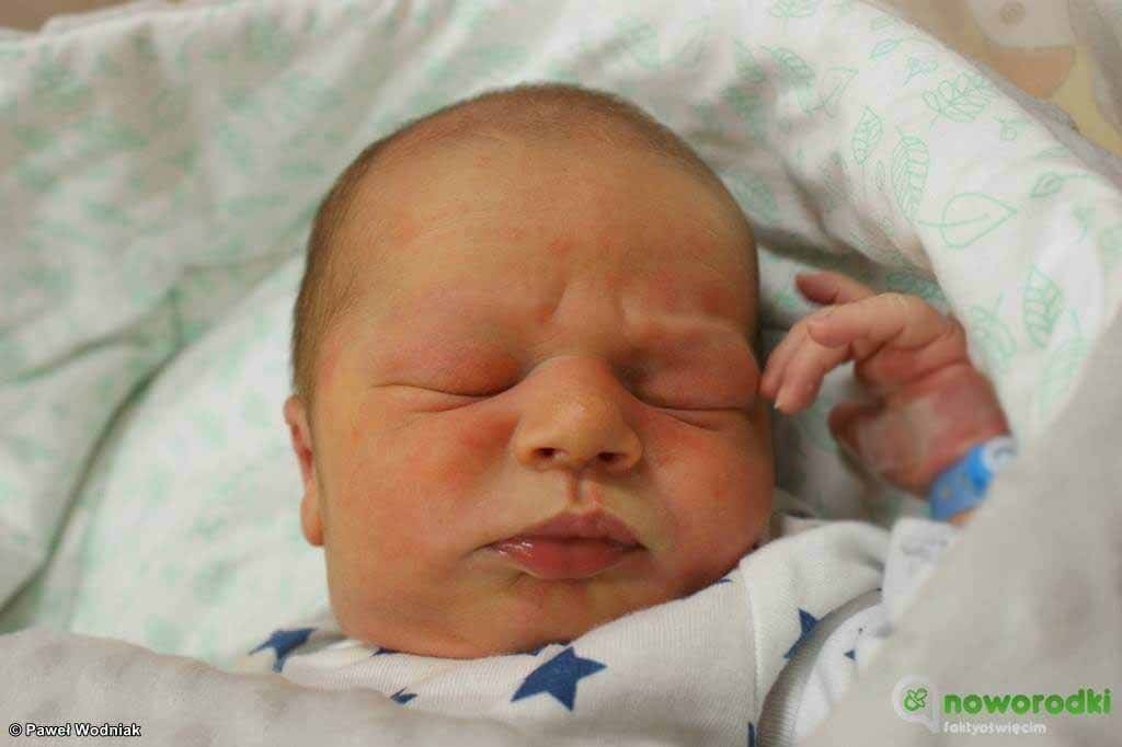 Noworodkowa galeria eFO – FOTO