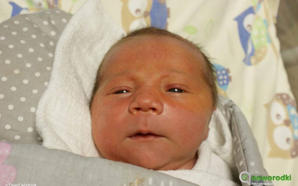 Noworodkowa galeria eFO – FOTO