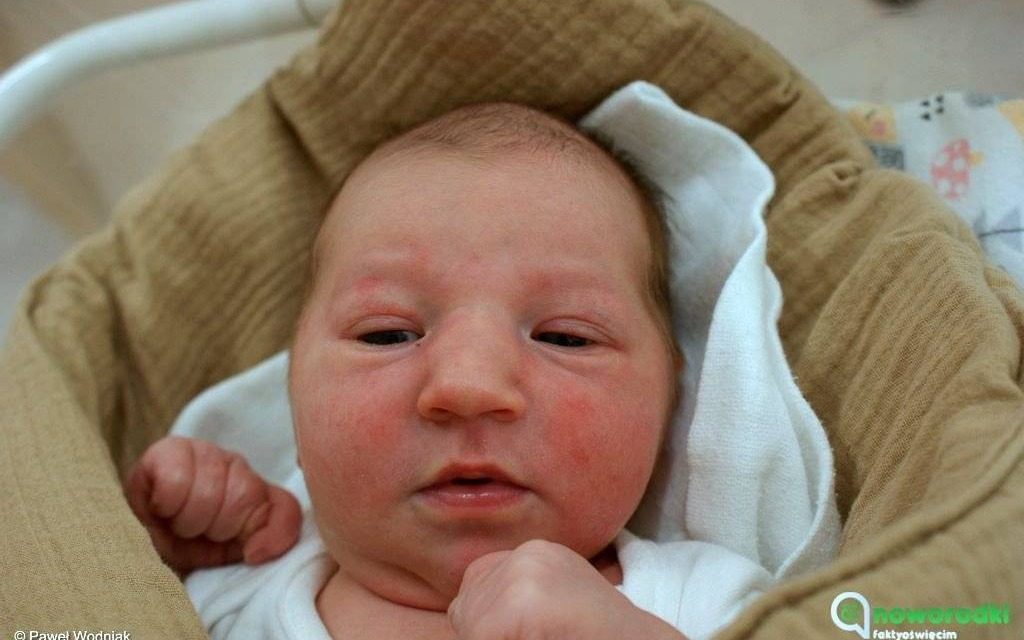 Noworodkowa galeria eFO – FOTO