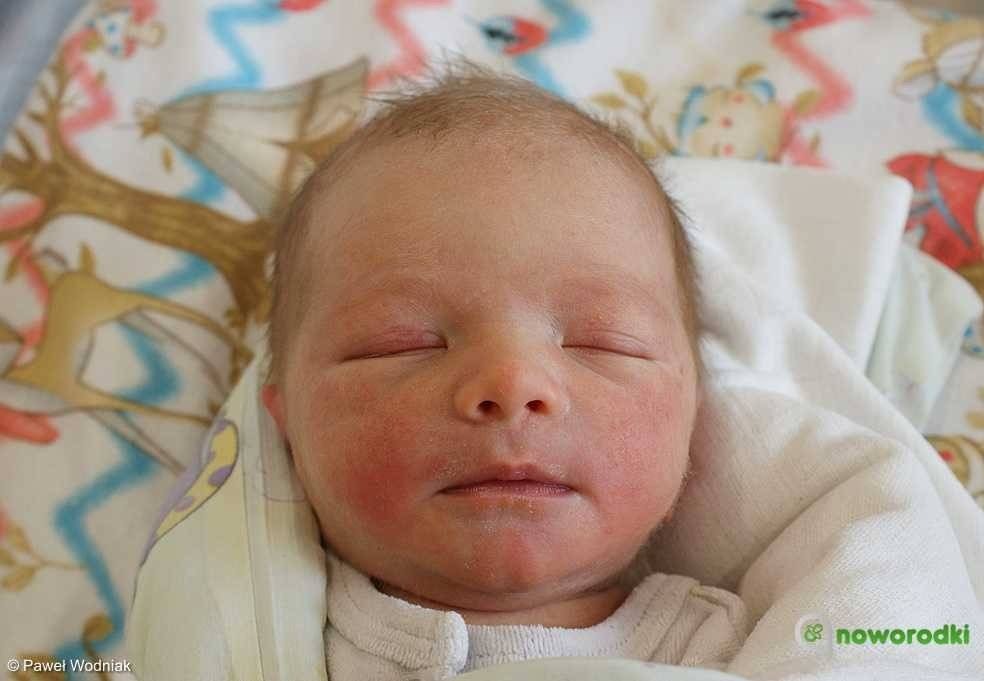 Noworodkowa galeria eFO – FOTO