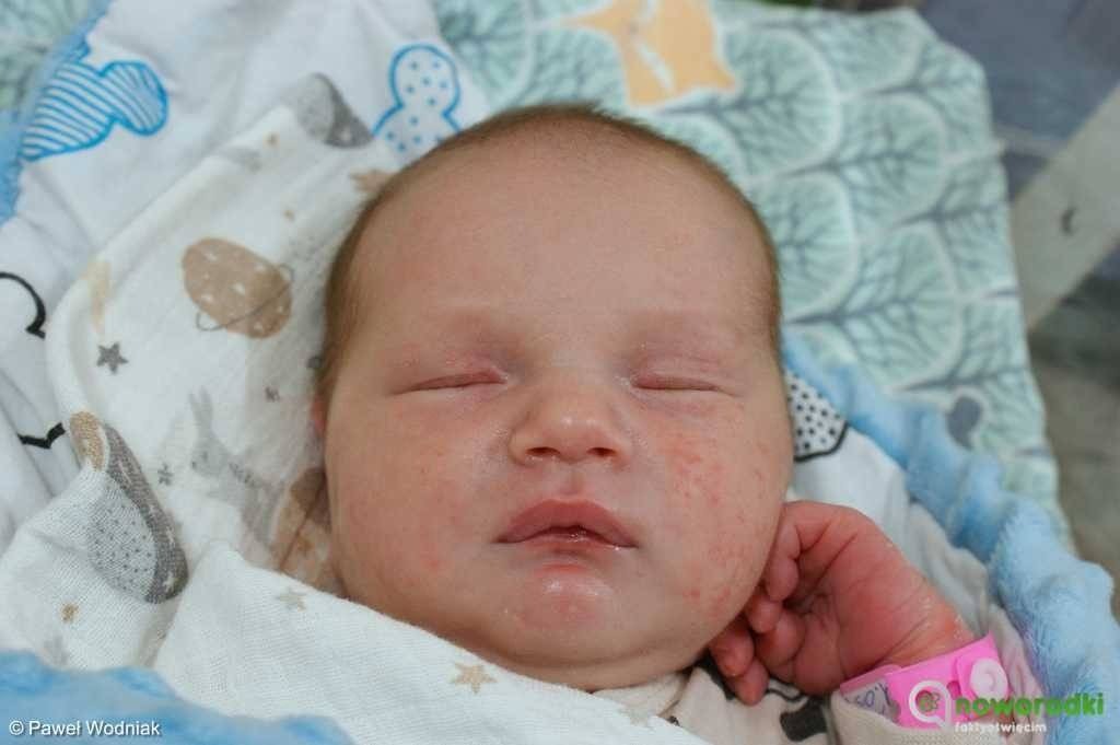 Noworodkowa galeria eFO – FOTO