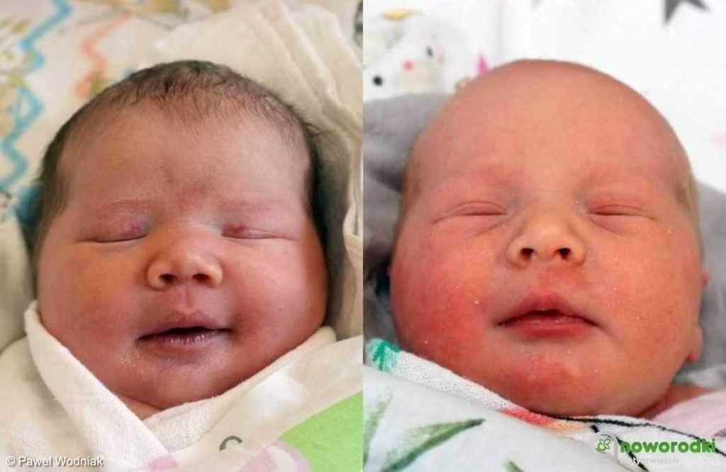 Noworodkowa galeria eFO – FOTO