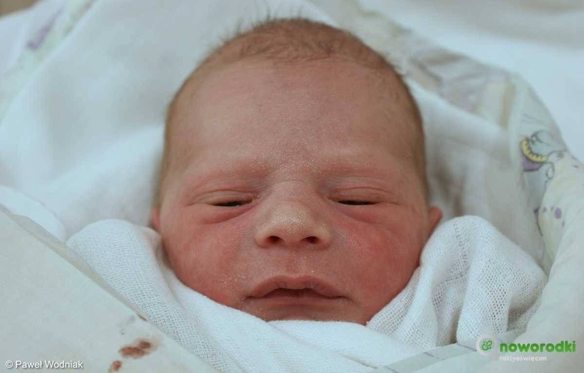 Noworodkowa galeria eFO – FOTO