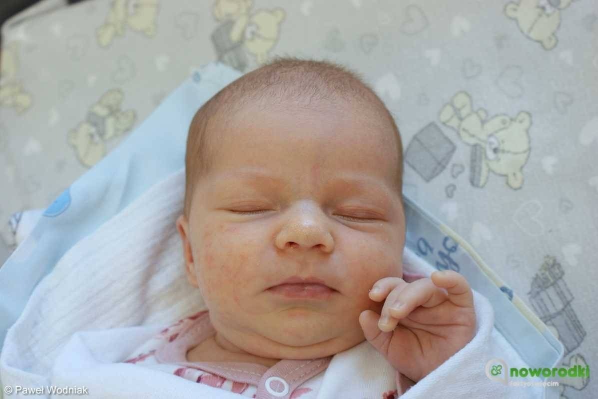 Noworodkowa galeria eFO – FOTO