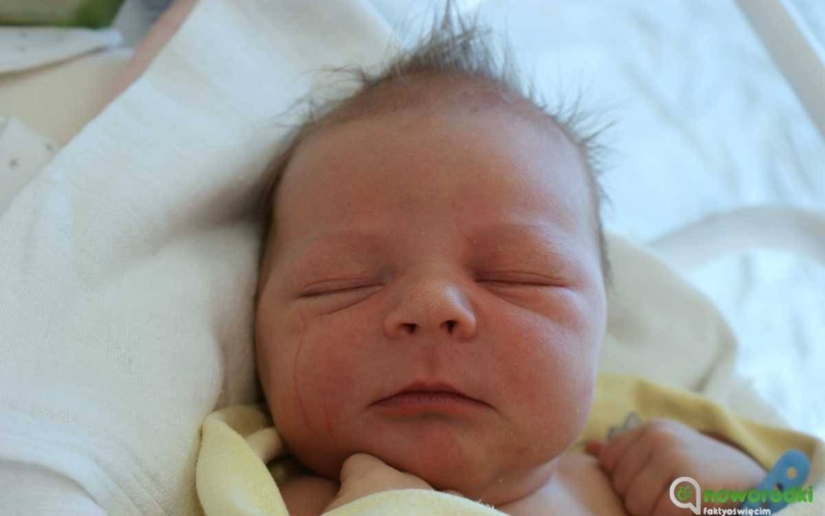 Noworodkowa galeria eFO – FOTO