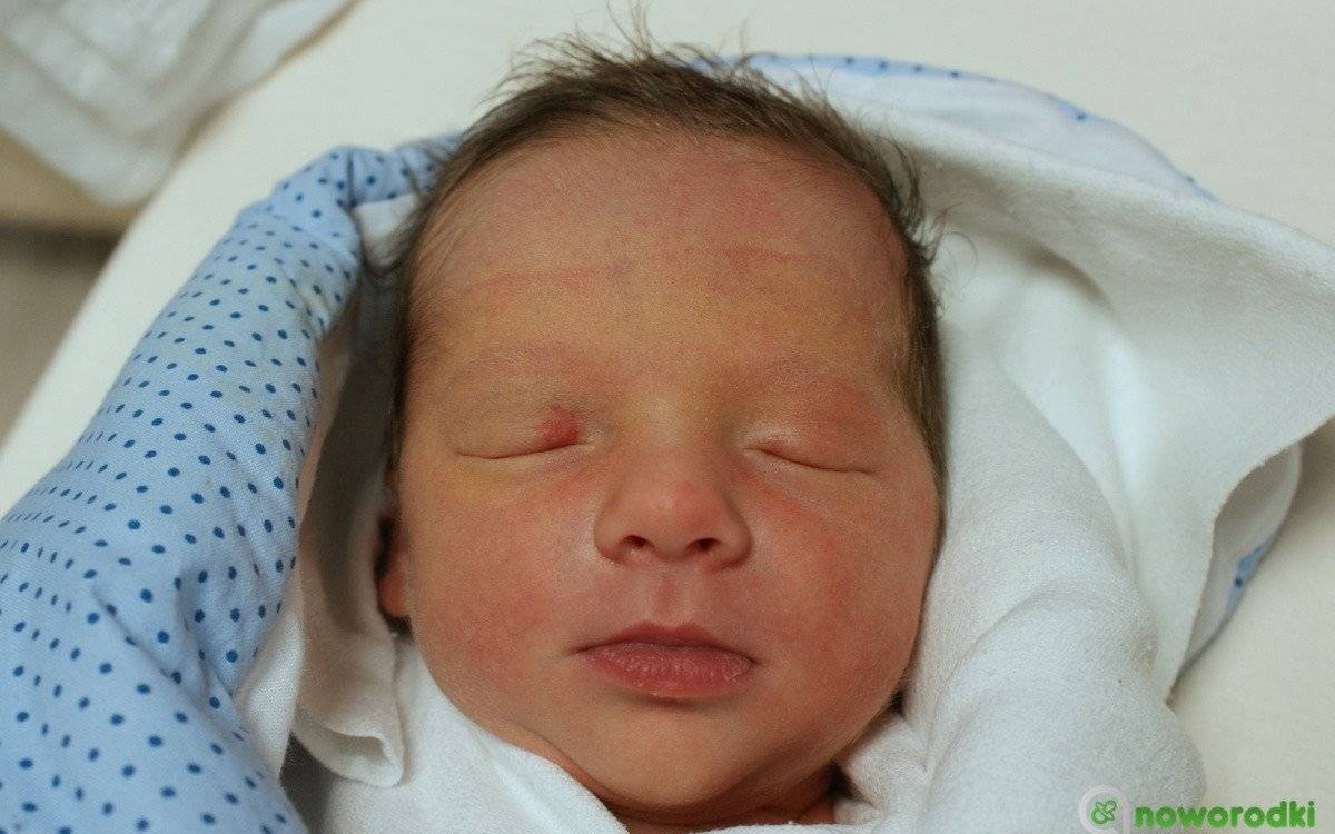 Noworodkowa galeria eFO – FOTO