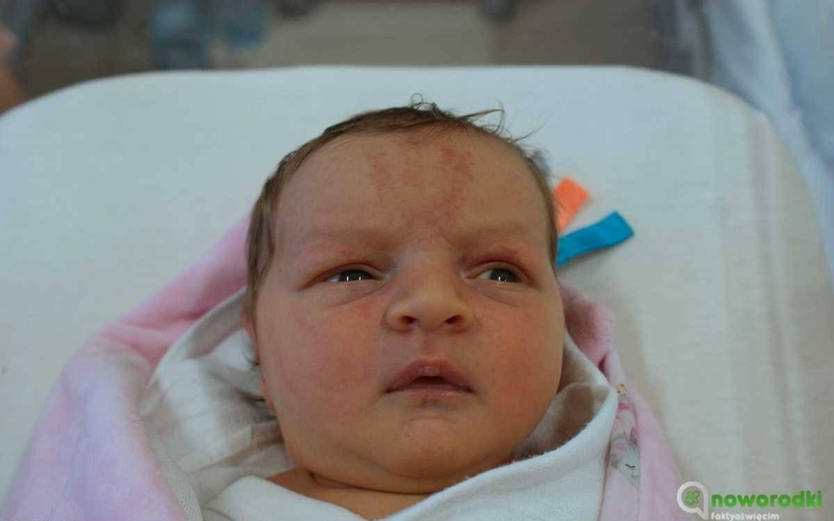 Noworodkowa galeria eFO – FOTO