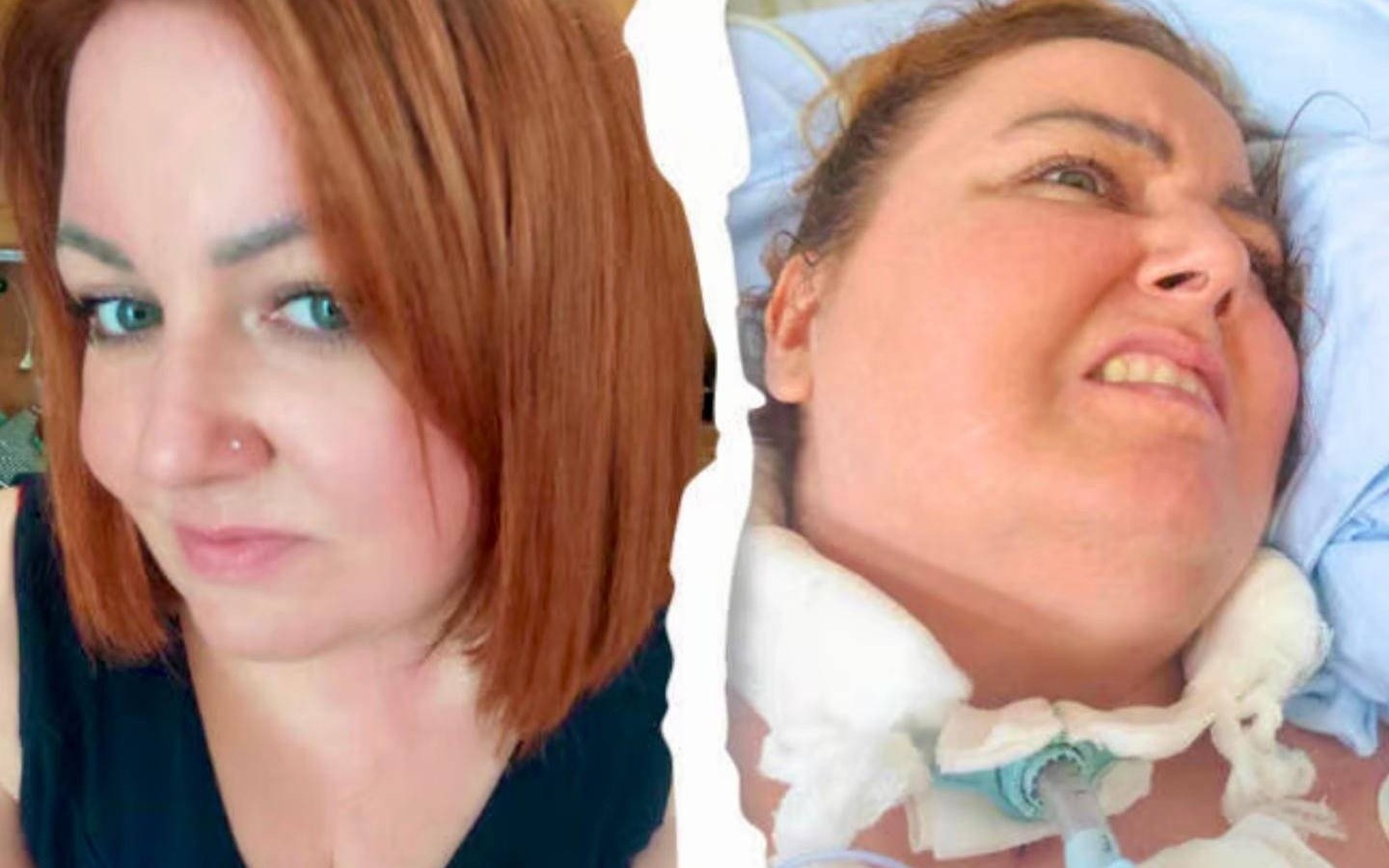 Monika z Brzeszcz walczy o życie. Wesprzyj leczenie i rehabilitację