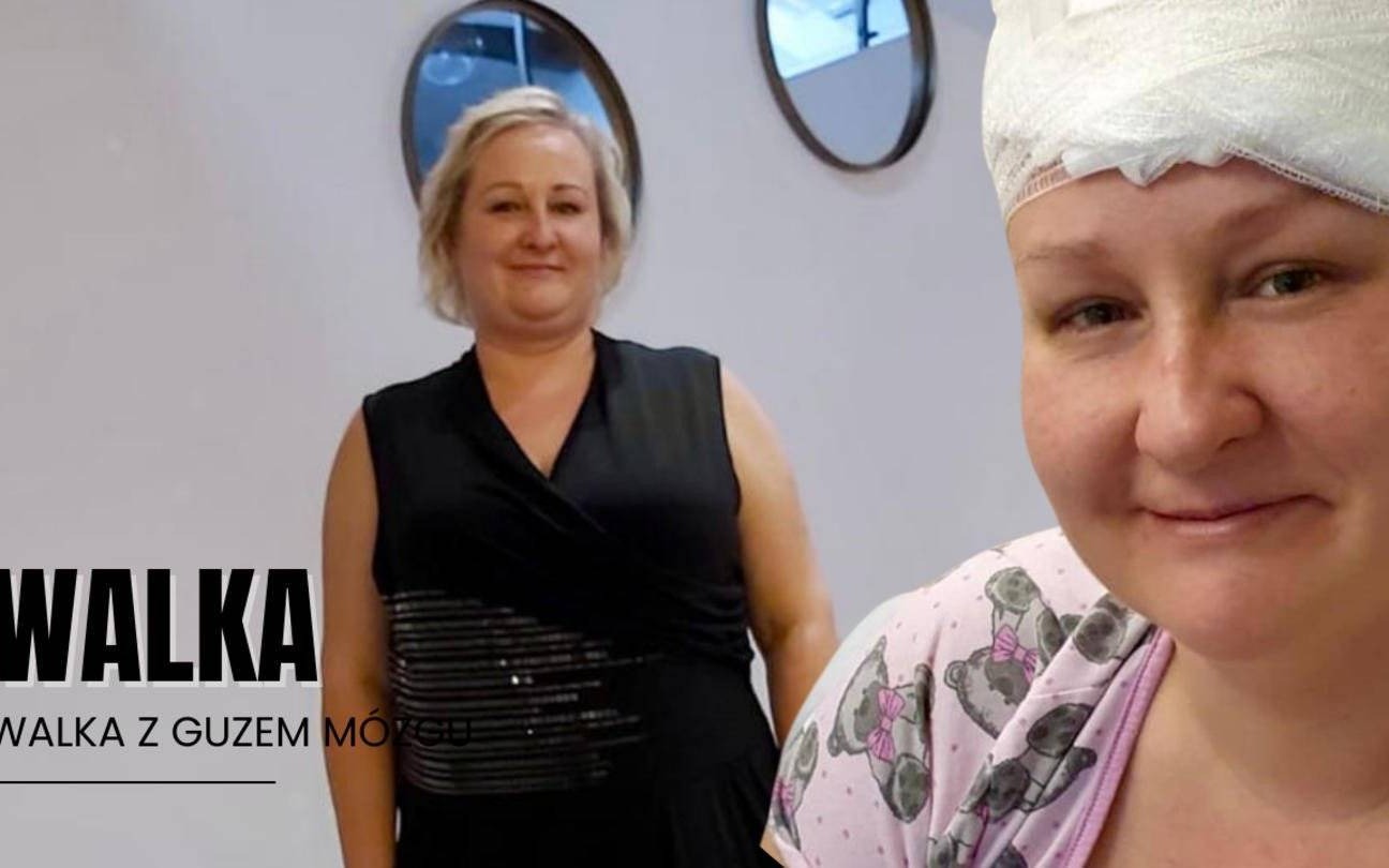 Walka z guzem mózgu. Karolina prosi o wsparcie w leczeniu i rehabilitacji