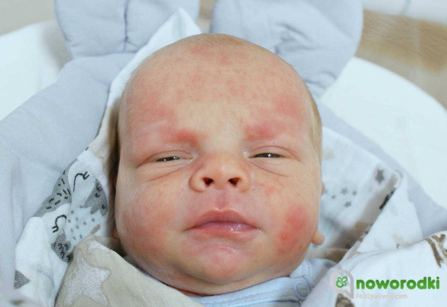 Noworodkowa galeria Faktów Oświęcim – FOTO