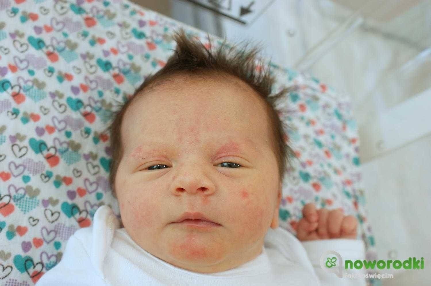 Noworodkowa galeria Faktów Oświęcim – FOTO