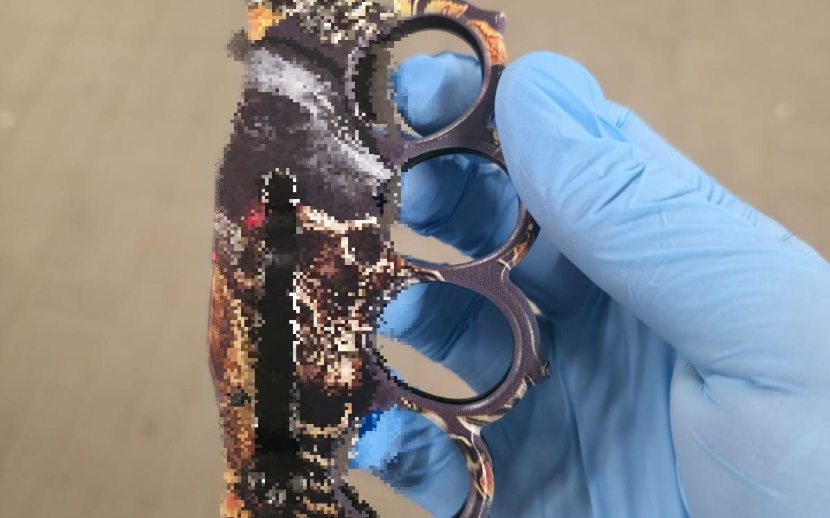 Wielkanocna interwencja służb: 17-letni obywatel Ukrainy raniony kastetem przez kolegę!