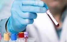 GZOZ w Kętach - tylko pilne badania laboratoryjne