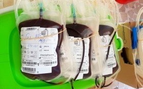 Grudniowe zbiórki krwi - sprawdź terminy i zarezerwuj czas