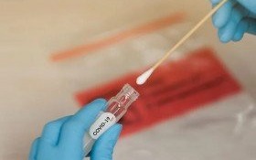 Ruszyły badania przesiewowe nauczycieli szkół podstawowych