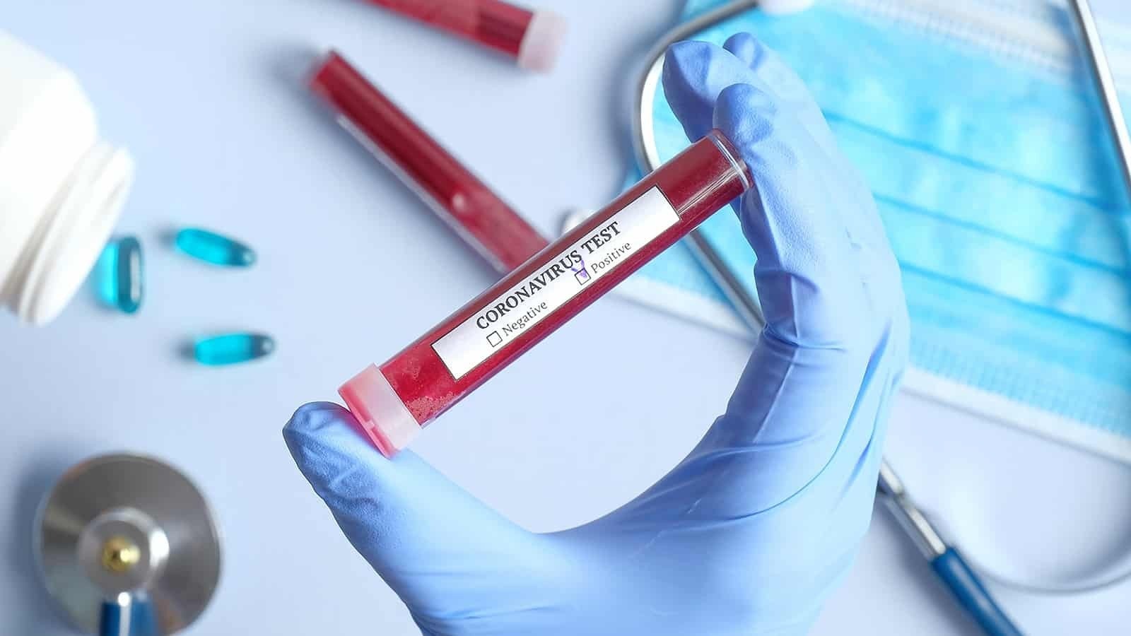 Co musisz wiedzieć o koronawirusie? - InfoBrzeszcze.pl