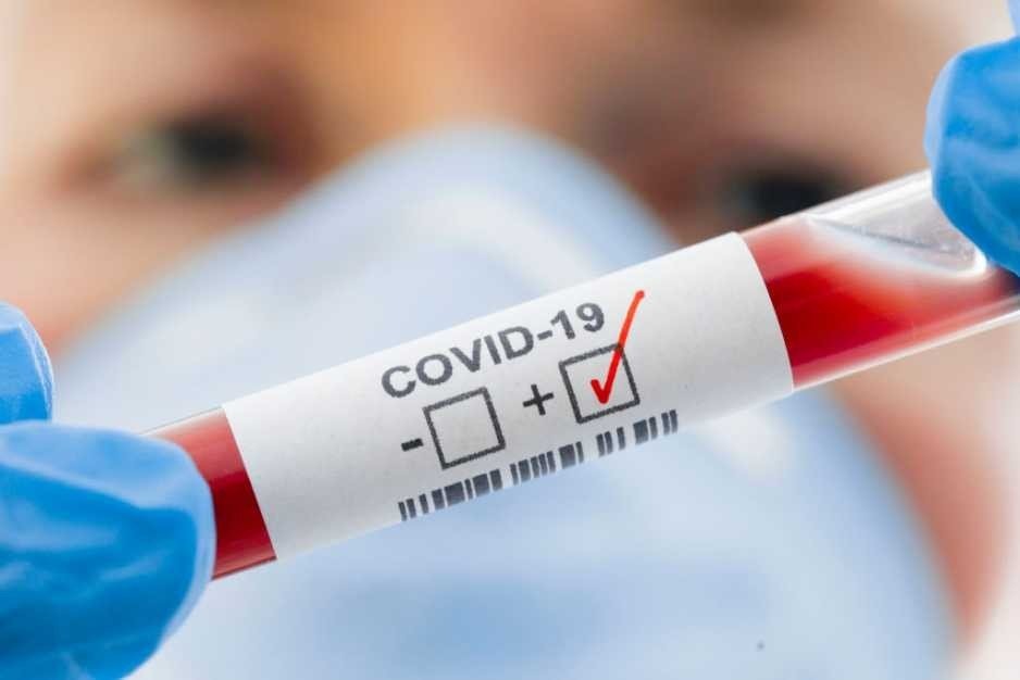 Dwóch mieszkańców Gminy Brzeszcze z wynikiem dodatnim w kierunku Covid-19 - InfoBrzeszcze.pl